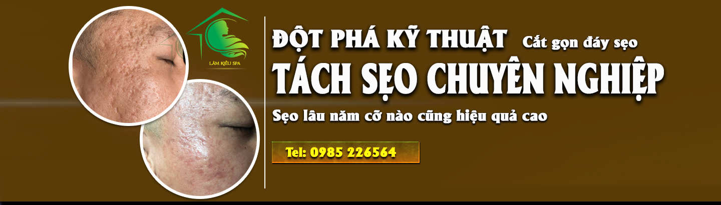 Dịch vụ Điều Trị Sẹo Rỗ