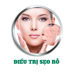 Điều Trị Sẹo Rỗ