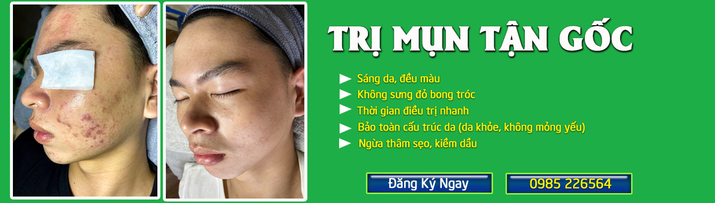Dịch vụ Trị Mụn