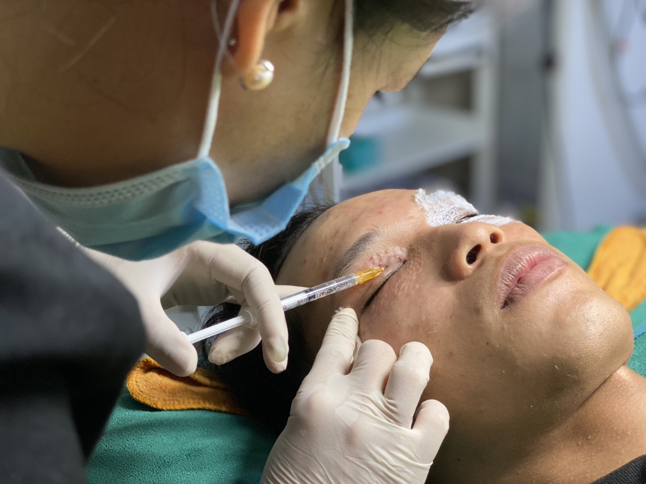 TRỊ THÂM MẮT VŨNG TÀU
