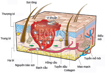 Cách hình thành sẹo