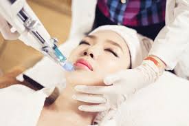 Cấy Dưỡng Chất 