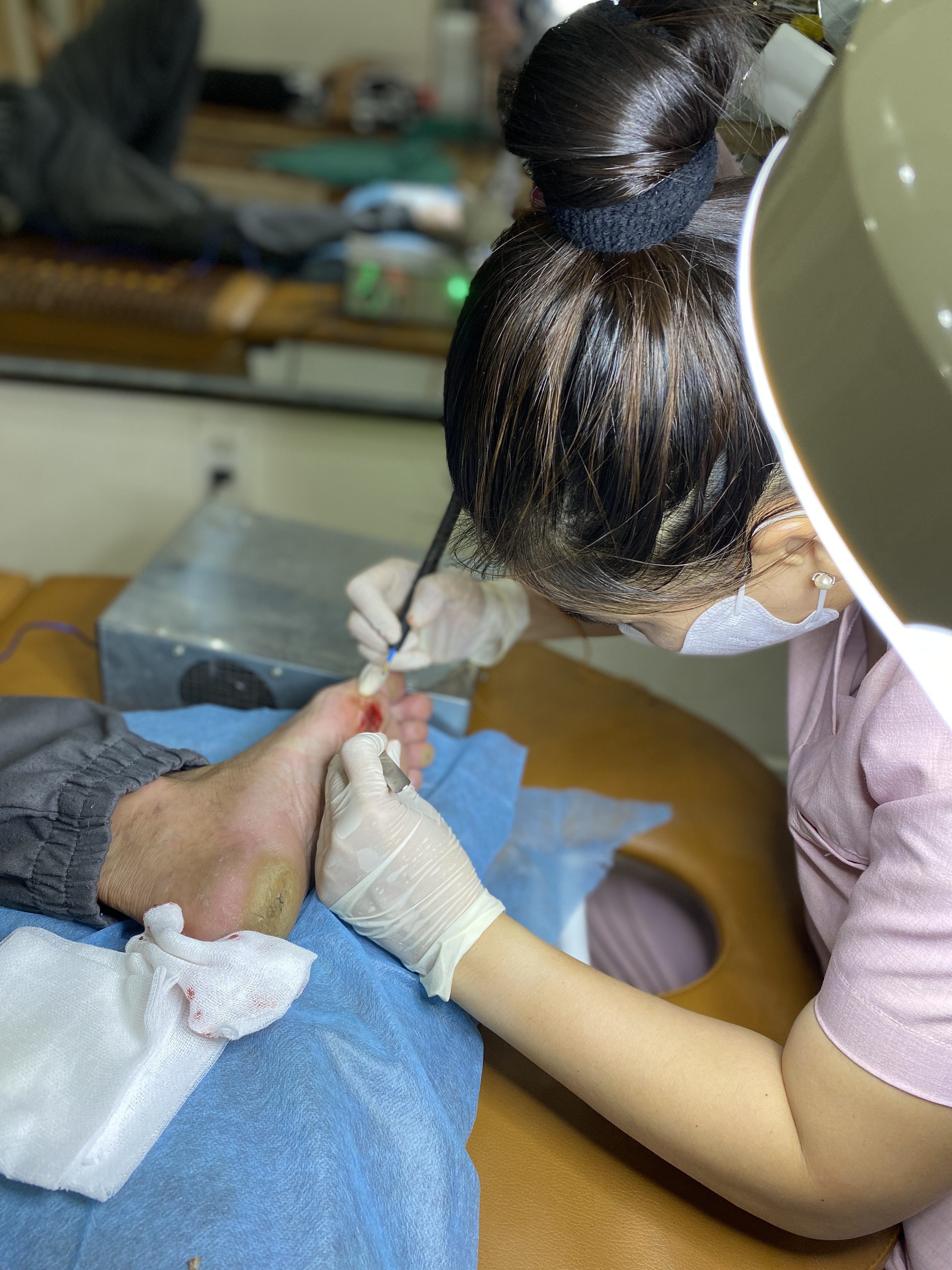 Trị mụn cóc tại vũng tàu